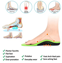 Carica l'immagine nel visualizzatore di Gallery, X/O Leg Correction - Free Shipping on Orders Over $30